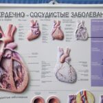 Слишком большое сердце. Что такое кардиомиопатия?