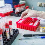 Минздрав Новосибирской области опроверг дефицит препаратов для диабетиков